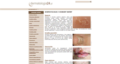 Desktop Screenshot of dermatologia24.pl